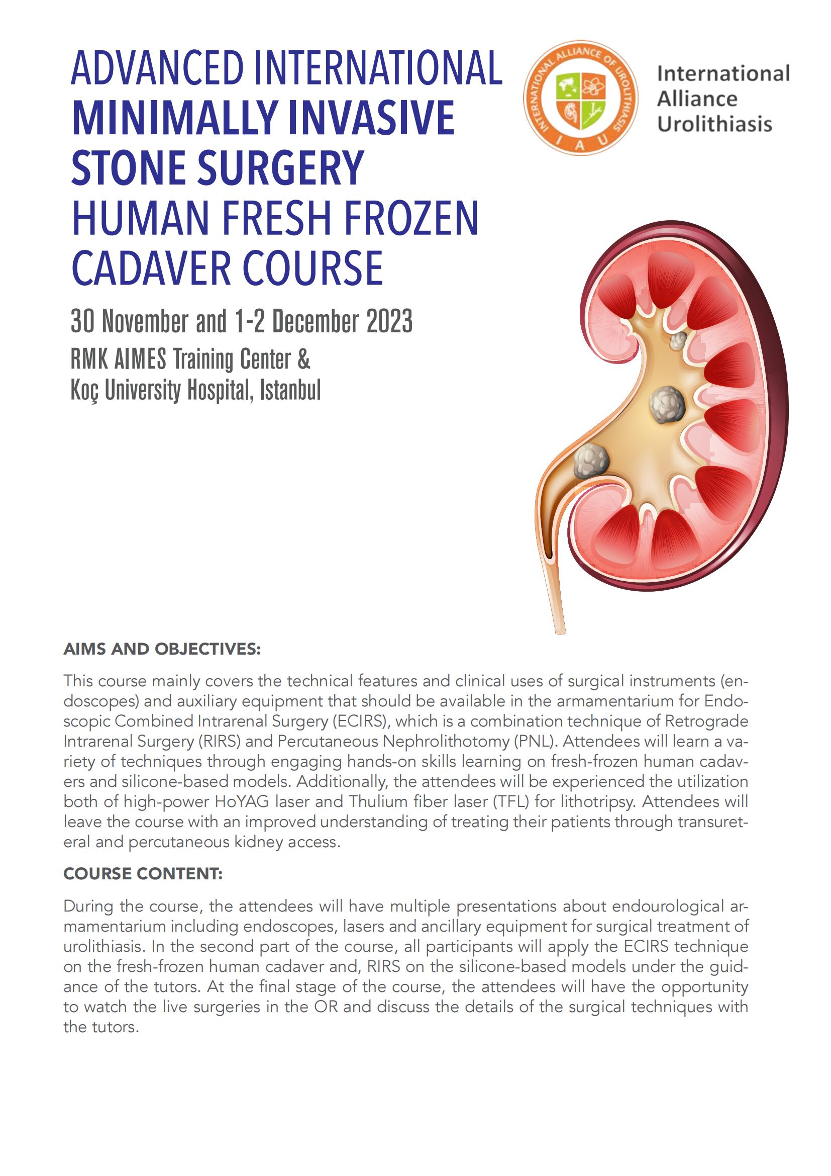 ADVANCED INTERNATIONAL MINIMALLY INVASIVE STONE SURGERY HUMAN FRESH ...